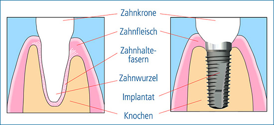 Camlog_Bild5